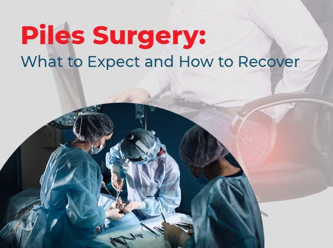 Piles Surgery: What to Expect and How to Recover