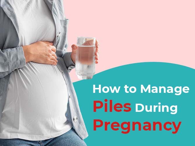 How to Manage Piles During Pregnancy