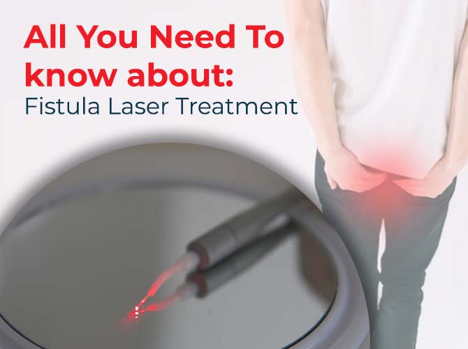 All You Need To know about: Fistula Laser Treatment