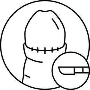 circumcision surgery