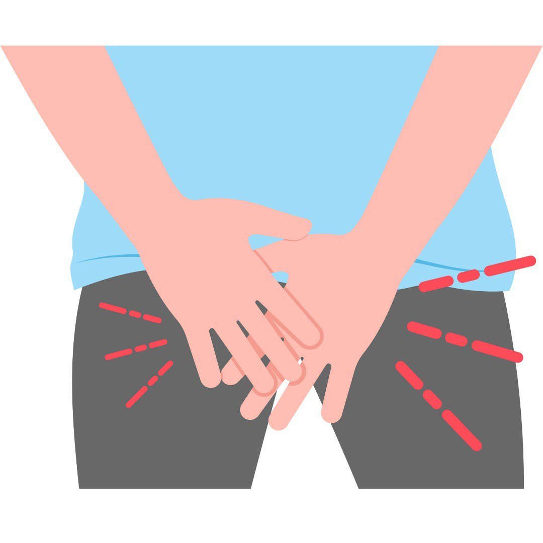 hydrocele treatment