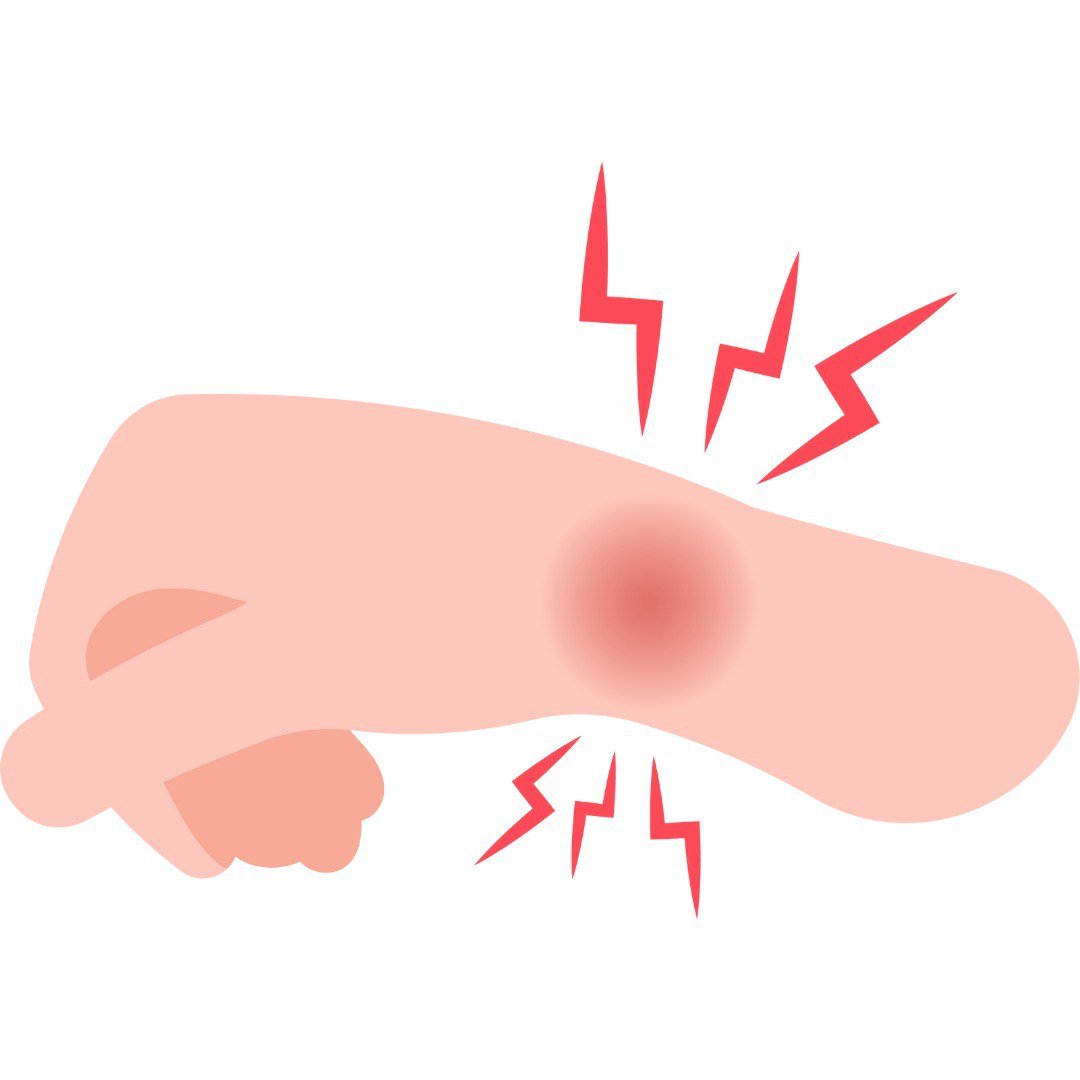 lipoma treatment