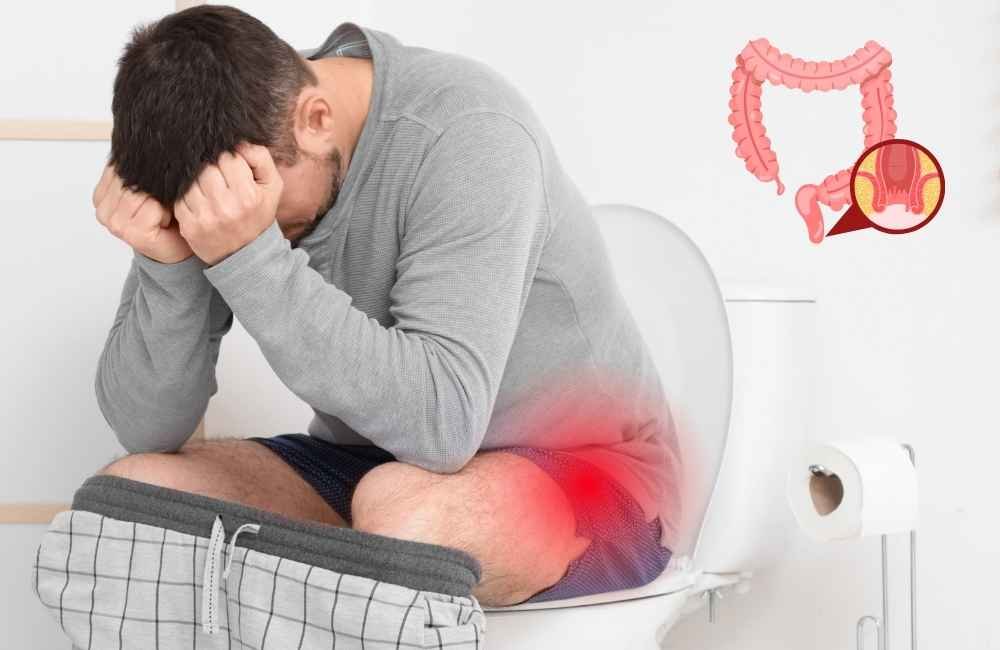 suffering for hemorrhoids or piles
