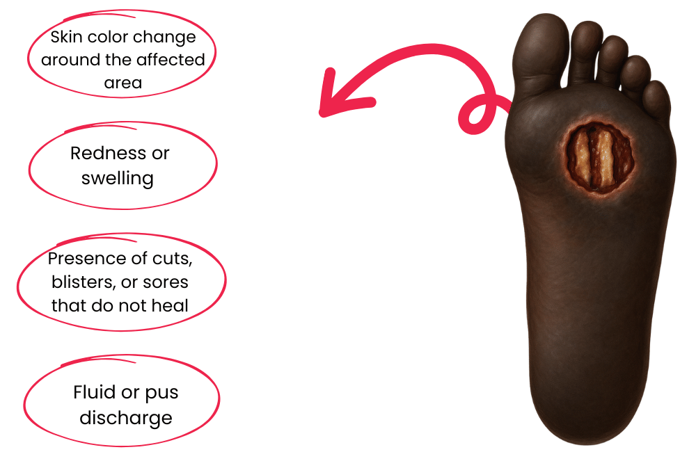 Diabetic foot