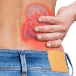 kidney stones